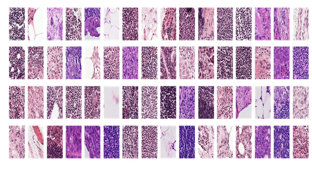 Identify Metastatic Cancer